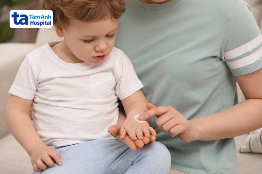 bôi thuốc giảm ngứa cho trẻ theo hướng dẫn của bác sĩ