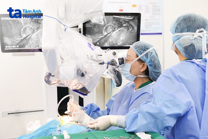 ca cấy điện cực ốc tai