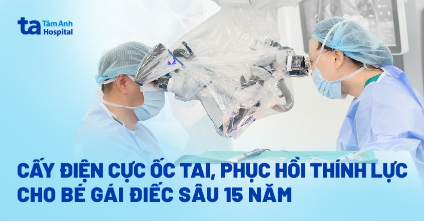 ca cấy điện ốc tai phục hồi thính lực