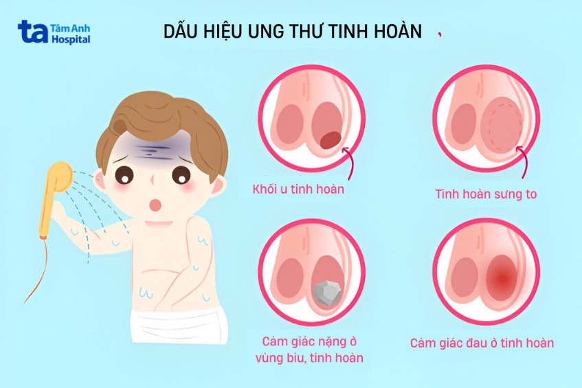 các dấu hiệu ung thư tinh hoàn