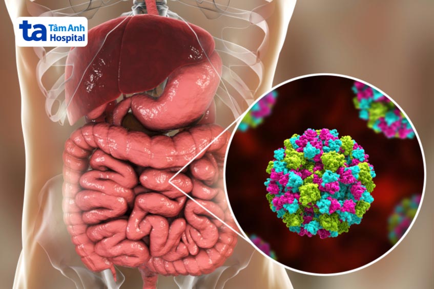 các virus gây viêm dạ dày