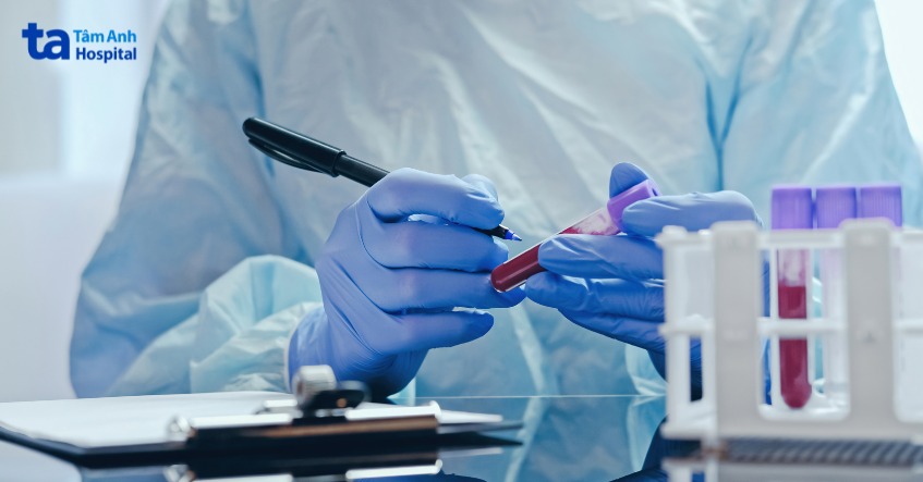 cách chẩn đoán đái rắt ở nữ giới