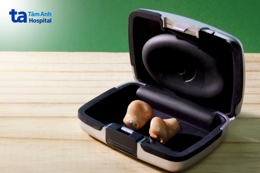 Dùng máy trợ thính có thể tháo rời chữa điếc 1 bên tai