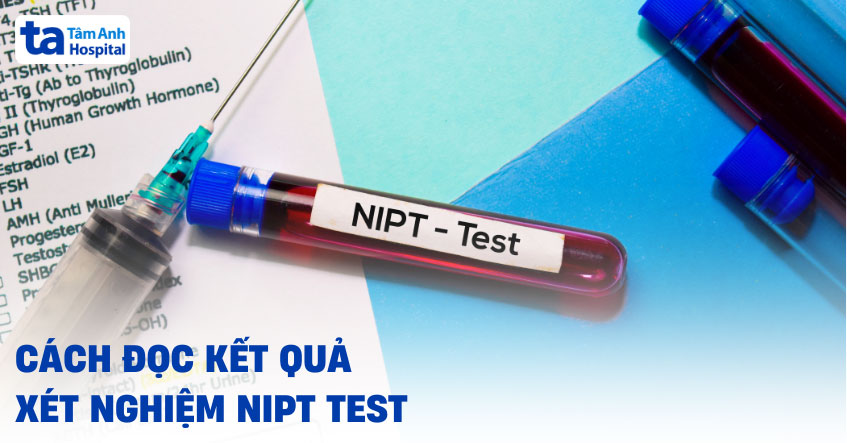Hướng dẫn cách đọc kết quả xét nghiệm NIPT đúng cho mẹ bầu
