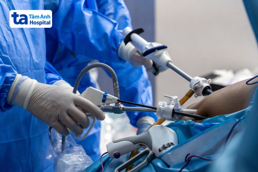 cắt polyp túi mật