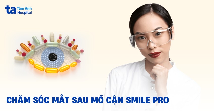 Hướng dẫn chăm sóc mắt sau mổ cận SMILE Pro giúp nhanh hồi phục