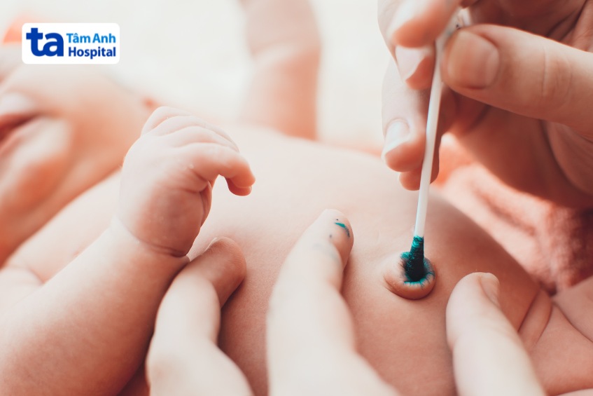 chăm sóc rốn đúng cách theo hướng dẫn của bác sĩ