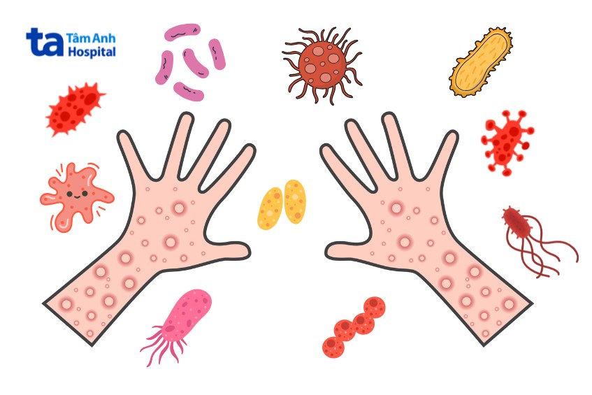 chăm sóc trẻ không đúng cách, không đảm bảo vệ sinh