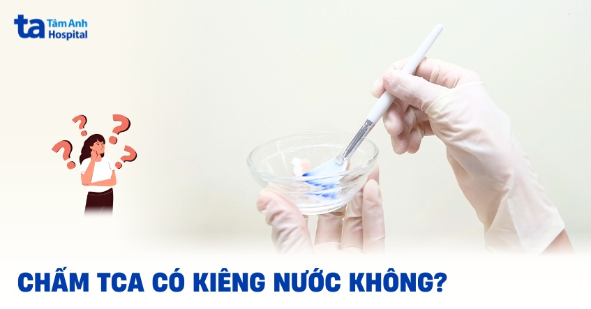 Sau chấm TCA có kiêng nước không? Có rửa mặt được không?