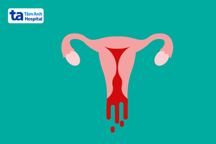 chị em thắc mắc thai sinh hóa bao lâu thì ra máu