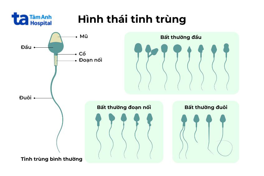 chia thành nhiều dạng bất thường ở đầu