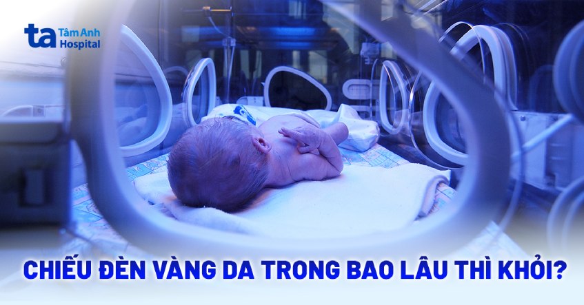 Chiếu đèn vàng da trong bao lâu thì khỏi? [Chuyên gia giải đáp]