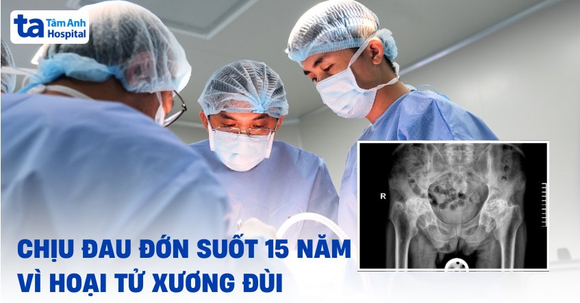chịu đau 15 năm vì hoại tử xương đùi