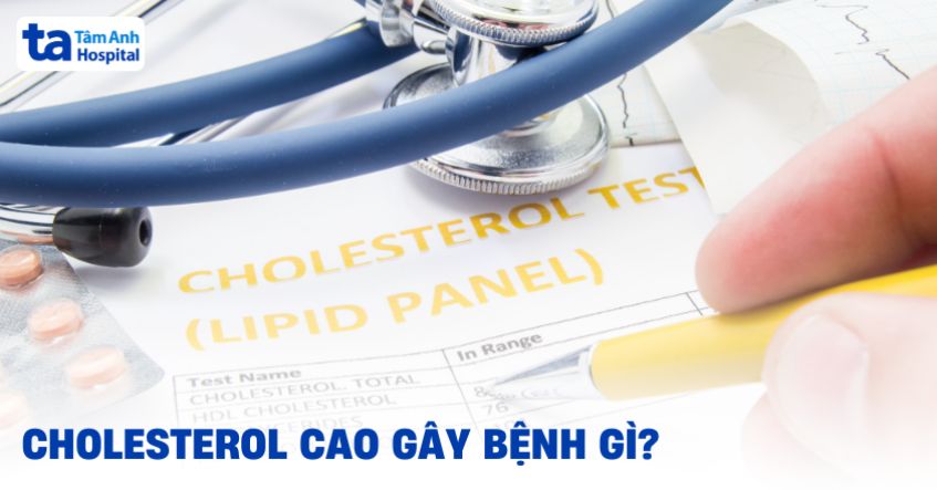 Cholesterol cao gây bệnh gì? 9 bệnh nguy hiểm có thể tiến triển