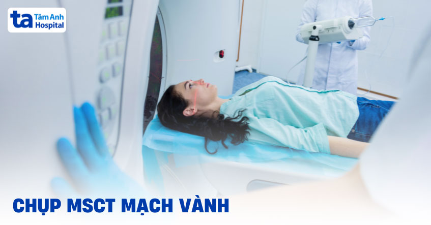 Chụp MSCT mạch vành là gì? Chỉ định thực hiện khi nào?