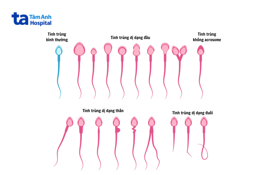 có chữa được không là thắc mắc chung của nhiều nam giới