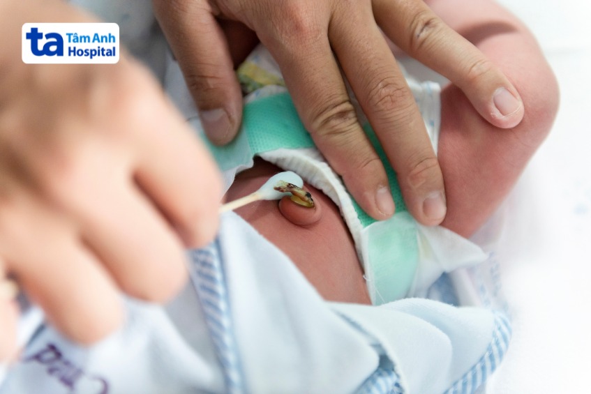 cuống rốn của trẻ sơ sinh nên được để rụng tự nhiên