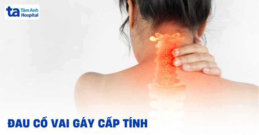 Đau cổ vai gáy cấp tính: Nguyên nhân, dấu hiệu và cách điều trị