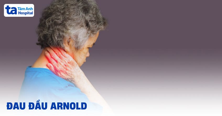 Đau đầu Arnold là gì? Nguyên nhân, triệu chứng và cách điều trị