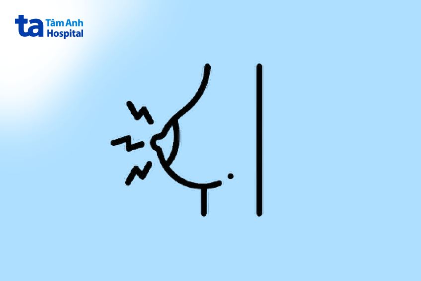 dấu hiệu núm vú bị sưng và đau ở phụ nữ