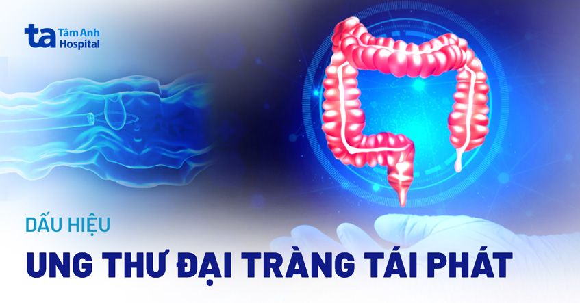 Các dấu hiệu ung thư đại tràng tái phát không nên xem thường