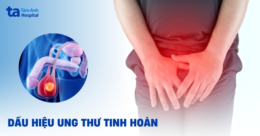 7 dấu hiệu ung thư tinh hoàn dễ nhận biết, không nên bỏ qua