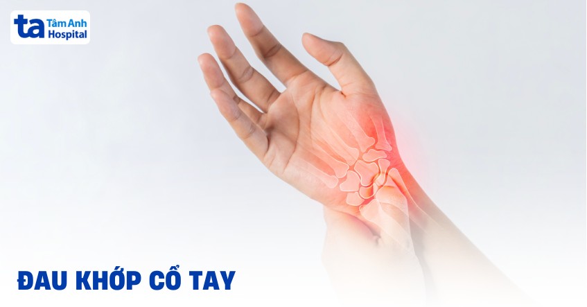 Đau khớp cổ tay là triệu chứng của bệnh gì? Nguyên nhân, chẩn đoán