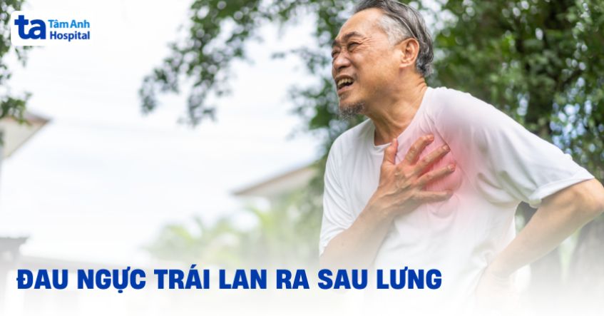 Đau ngực trái lan ra sau lưng: Nguyên nhân và cách điều trị