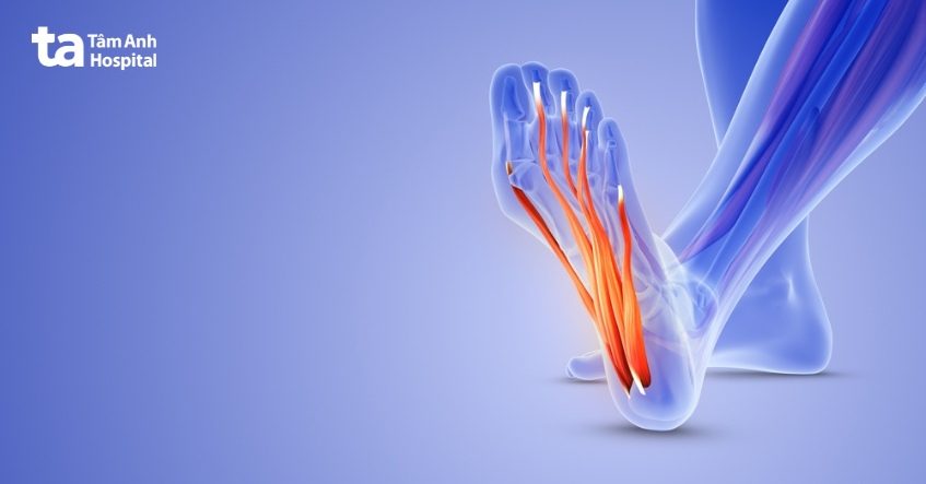 dây thần kinh bị tổn thương có thể gây nóng rát bàn chân