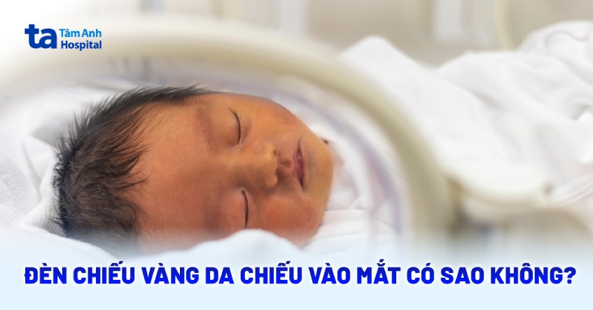Đèn chiếu vàng da chiếu vào mắt có sao không? Có hại không?