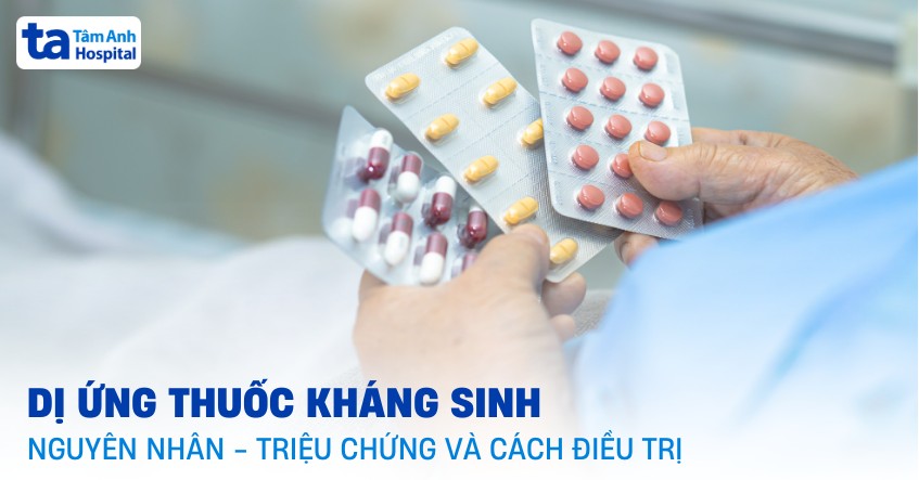 Dị ứng thuốc kháng sinh: Nguyên nhân, triệu chứng và chẩn đoán