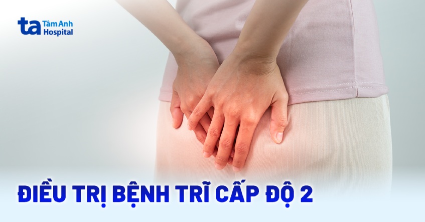 điều trị bệnh trĩ cấp độ 2