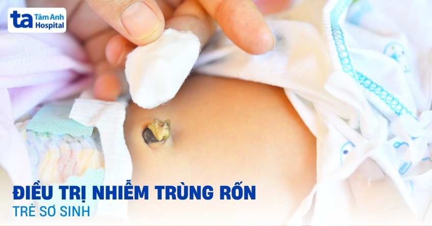 3 điều trị nhiễm trùng rốn ở trẻ sơ sinh giúp bé mau khỏe