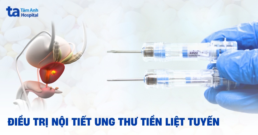 Điều trị nội tiết ung thư tiền liệt tuyến: Chỉ định, tác dụng phụ