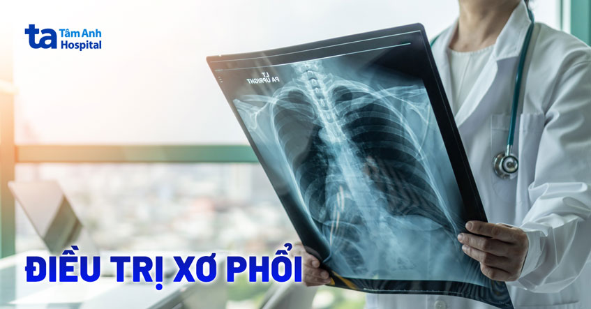 điều trị xơ phổi