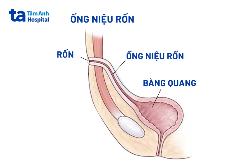định nghĩa ống niệu rốn
