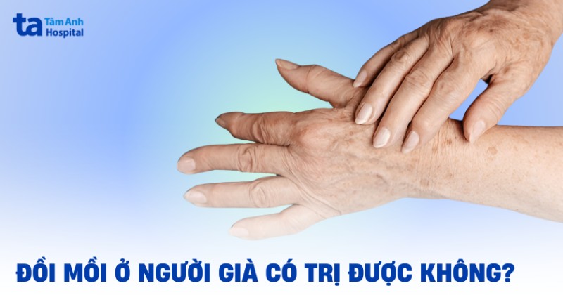 Đồi mồi ở người già có điều trị được không? Cách ngăn ngừa