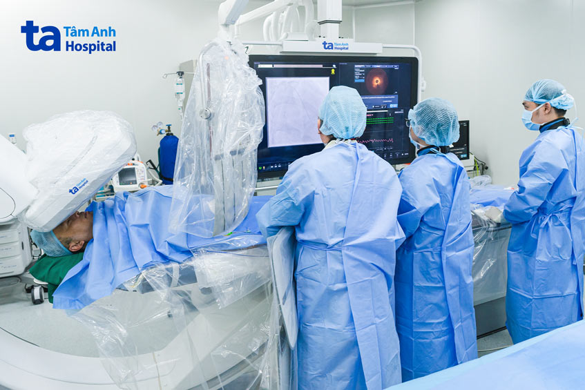 Ê kíp bác sĩ Trung tâm Tim mạch Can thiệp, Bệnh viện Đa khoa Tâm Anh TP.HCM đặt stent cấp cứu nhồi máu cơ tim cho đạo diễn Nguyễn Quang Dũng