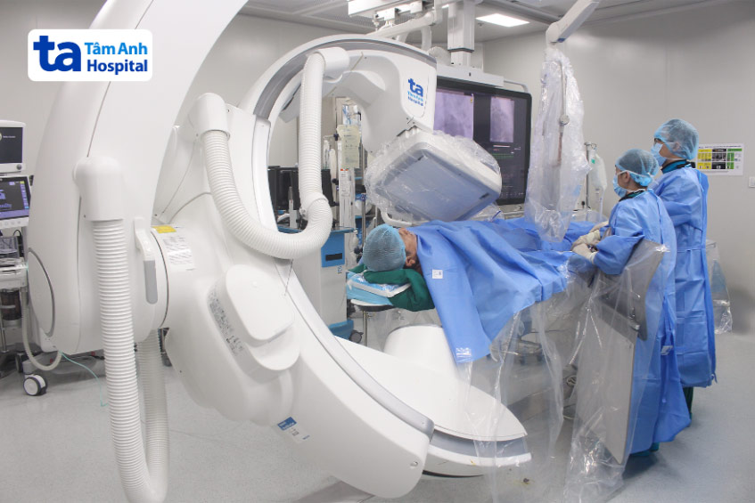 Êkíp bác sĩ can thiệp đặt stent cho người bệnh