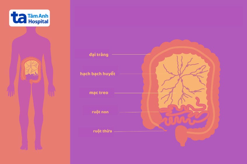 hạch bạch huyết ở mạc treo bị sưng viêm