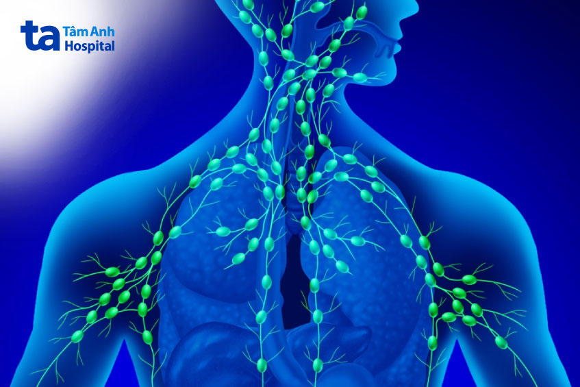 hạch thường xuất hiện ở cổ, hàm hoặc cằm