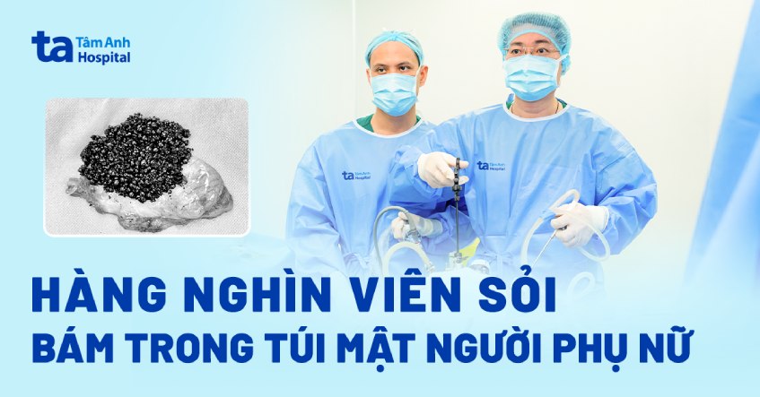 hàng nghìn viên sỏi bám trong túi mật