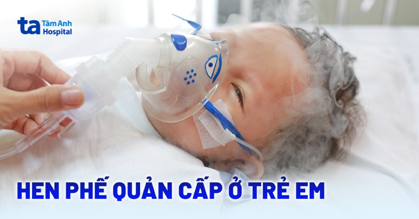 Hen phế quản cấp ở trẻ em: Nguyên nhân và cách xử trí hiệu quả