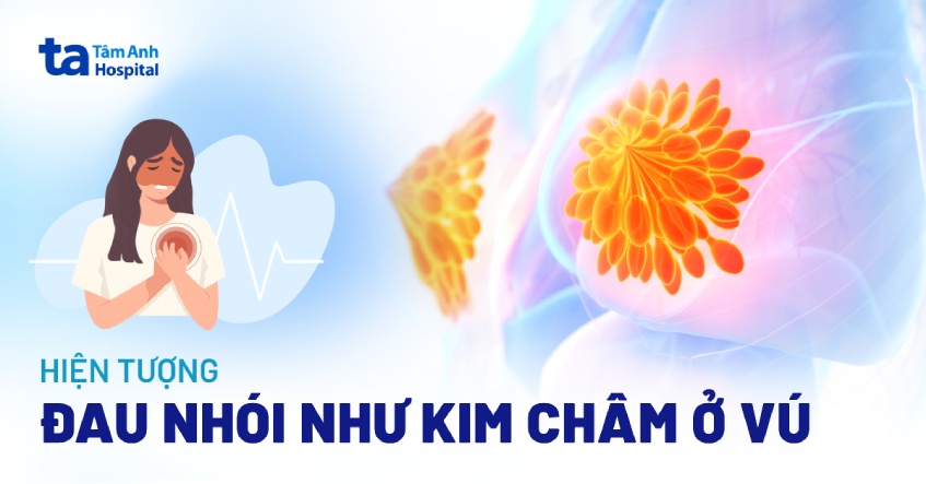 Hiện tượng đau nhói như kim châm ở vú là gì? Nguyên nhân do đâu?
