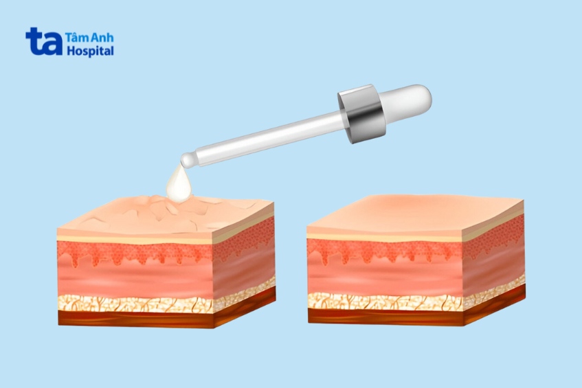 hiểu thêm về cơ chế hoạt động của tca trên da