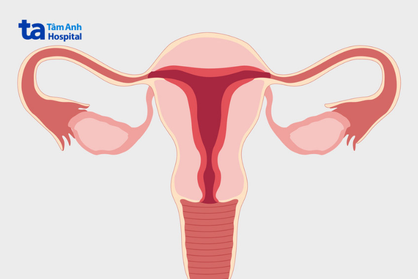 hình ảnh tử cung dị dạng ở phụ nữ