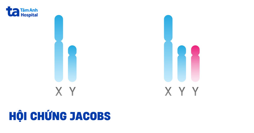 hội chứng jacobs