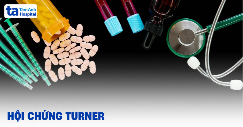 Hội chứng Turner: Nguyên nhân, dấu hiệu và cách phòng tránh