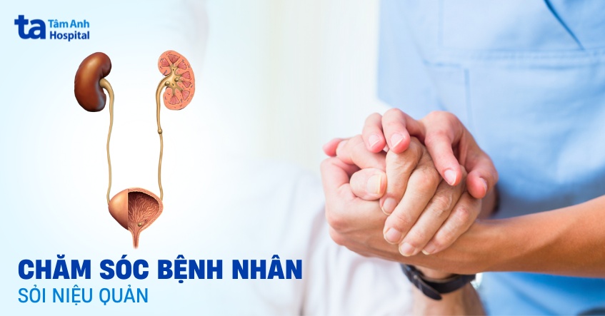 Lập kế hoạch chăm sóc bệnh nhân sỏi niệu quản tại nhà chi tiết