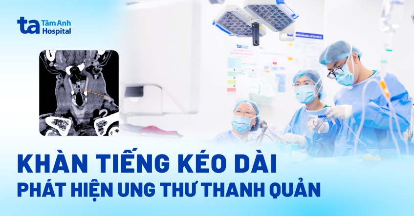 Khàn tiếng kéo dài, phát hiện ung thư thanh quản